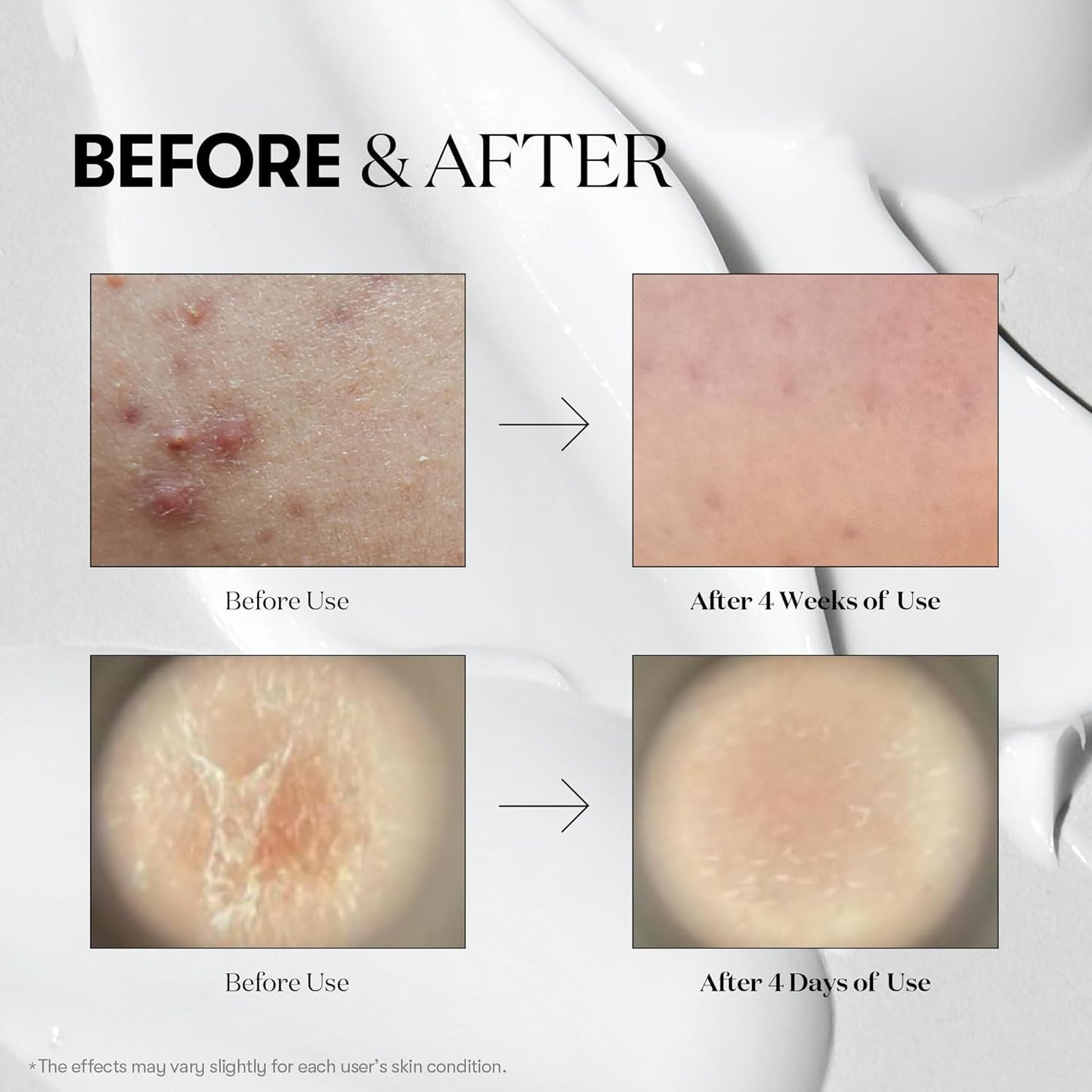CICA Reedle Shot 100 Microneedling Serum for Pore Care and Exfoliation with Exosome and Centella Asiatica for Enhanced Skin Texture, Korean Liquid Skin Booster (1.69 Fl Oz / 50 mL)