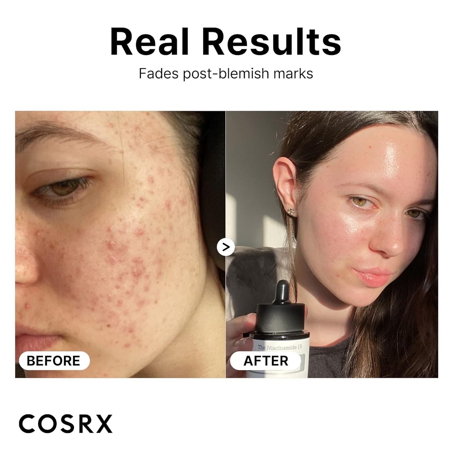 Glow Up with Our 15% Niacinamide Face Serum! 🌟 Pore Minimizing & Skin Tone Perfecting - Your New Korean Skincare Essential! 💖