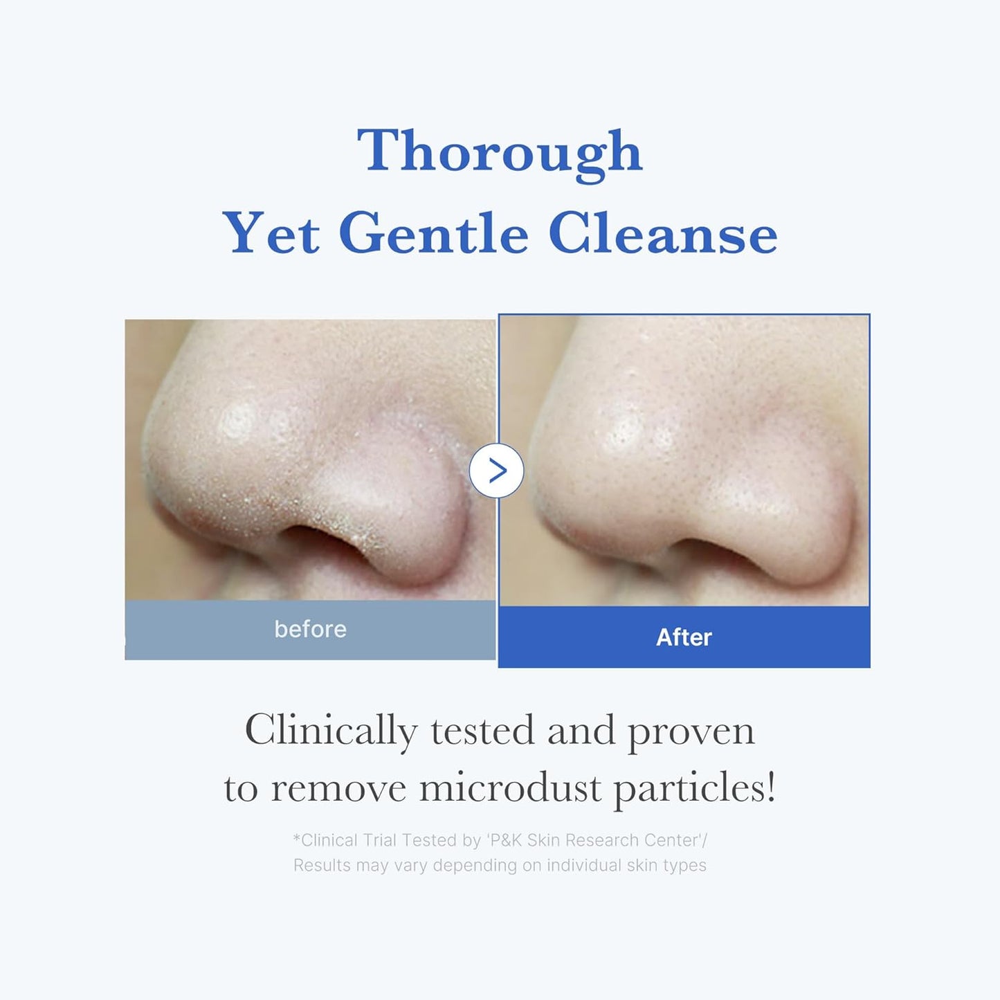 Zero Foam Cleanser for Sensitive Skin - Sebum Control, Moisture Balance, and Pore Minimization | Korean Skincare blackrose picks blackrose picks