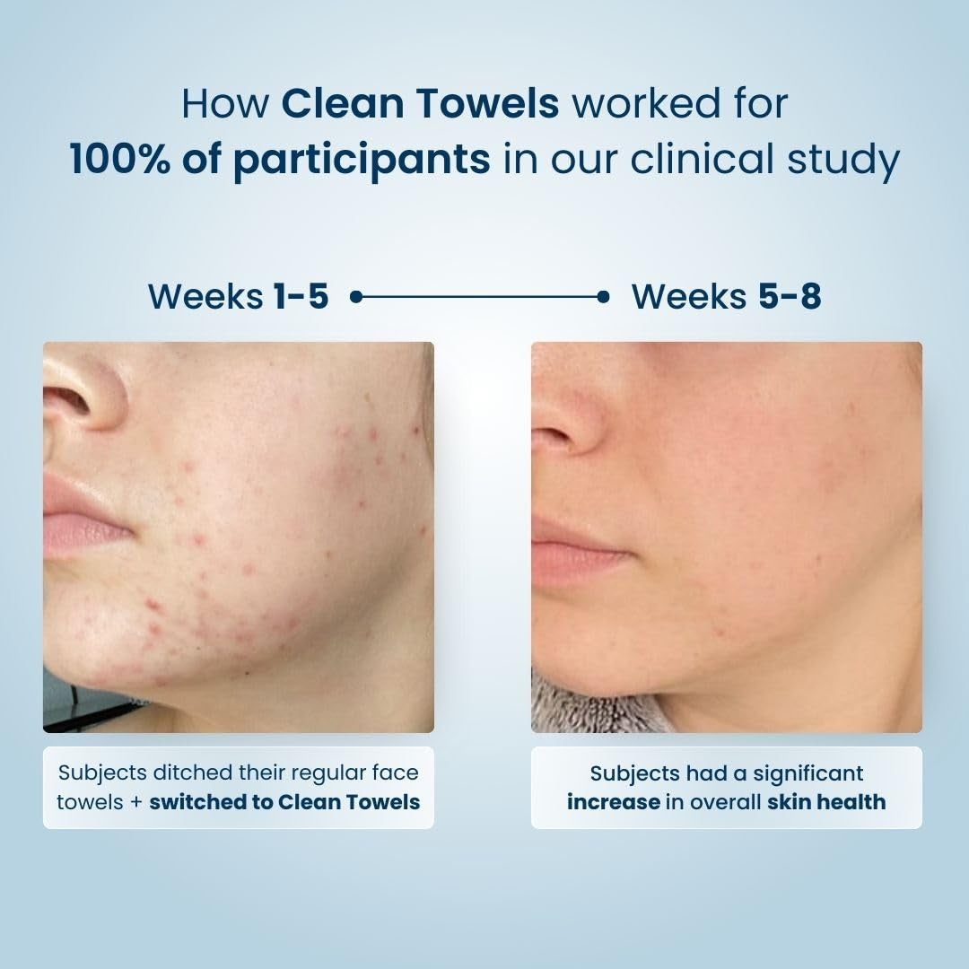 Say goodbye to stubborn makeup with our XL Biobased Face Towels! 🌿✨ Approved by the Eczema Association, these ultra-soft disposable wipes come in a 50 count pack. Perfect for sensitive skin! 💖 #MakeupRemover #EcoFriendly #SkincareEssentials