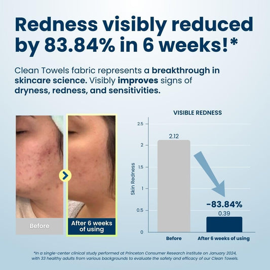 Say goodbye to stubborn makeup with our XL Biobased Face Towels! πΏβ¨ Approved by the Eczema Association, these ultra-soft disposable wipes come in a 50 count pack. Perfect for sensitive skin! π #MakeupRemover #EcoFriendly #SkincareEssentials