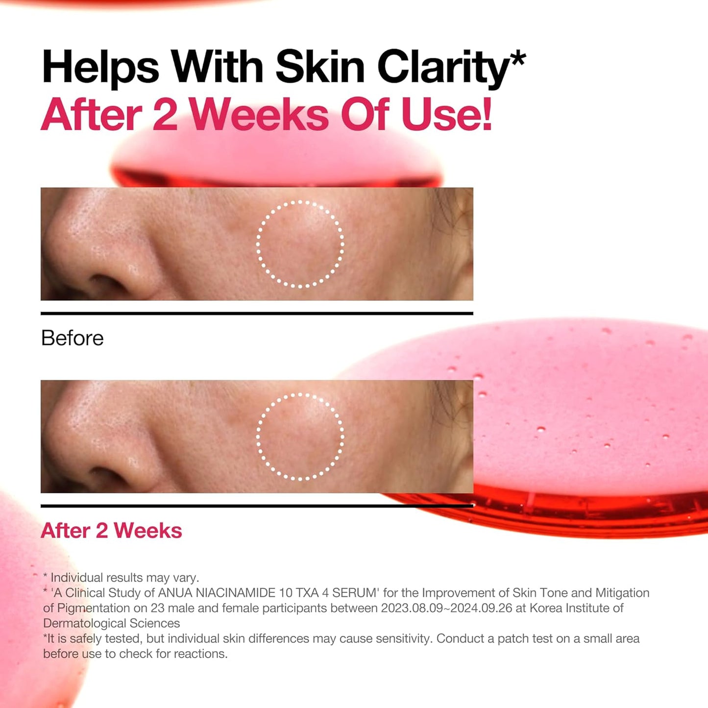 Niacinamide 10% and Tranexamic Acid 4% Serum with Hyaluronic Acid and Vitamin B12 for Enhanced Radiance, 30ml