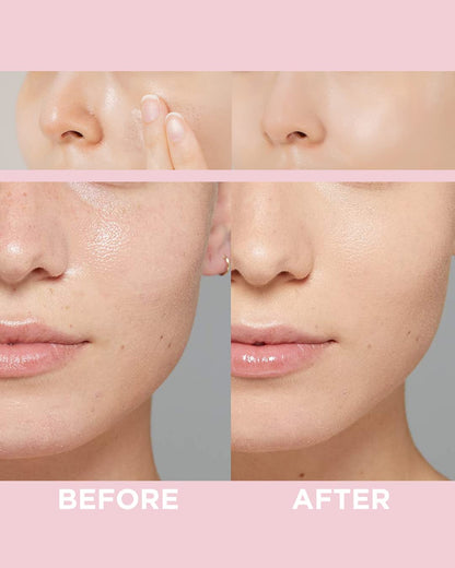 Say goodbye to pores and hello to flawless skin! 🌟✨ Check out our No Pore Blem Primer for a smooth finish and all-day makeup wear! 💖 #MakeupMustHave #FlawlessSkin