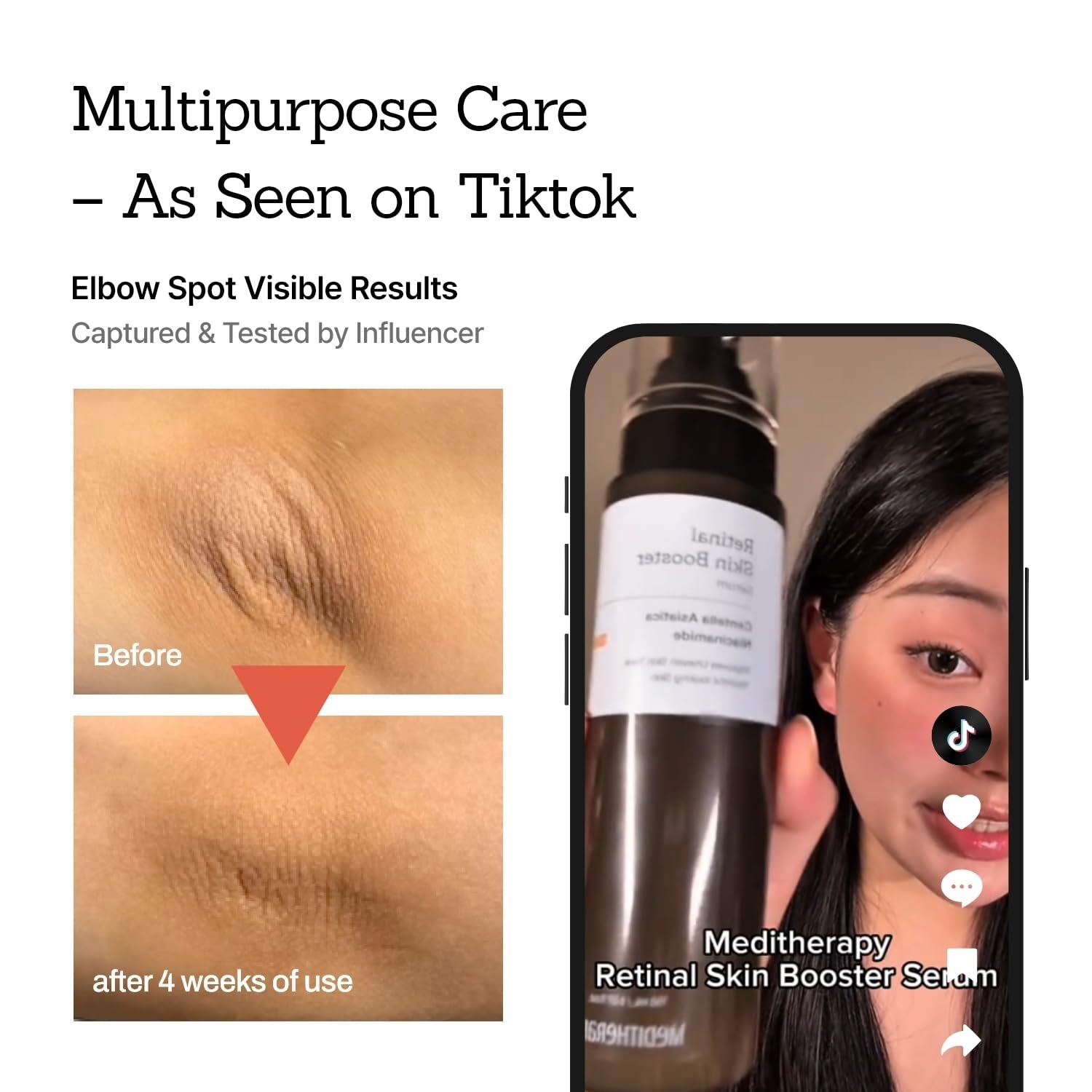 Revitalize Your Skin with Our Vegan Retinal Booster Serum! Perfect for Sensitive Skin, Uneven Tone, and Fine Lines! 🌟✨