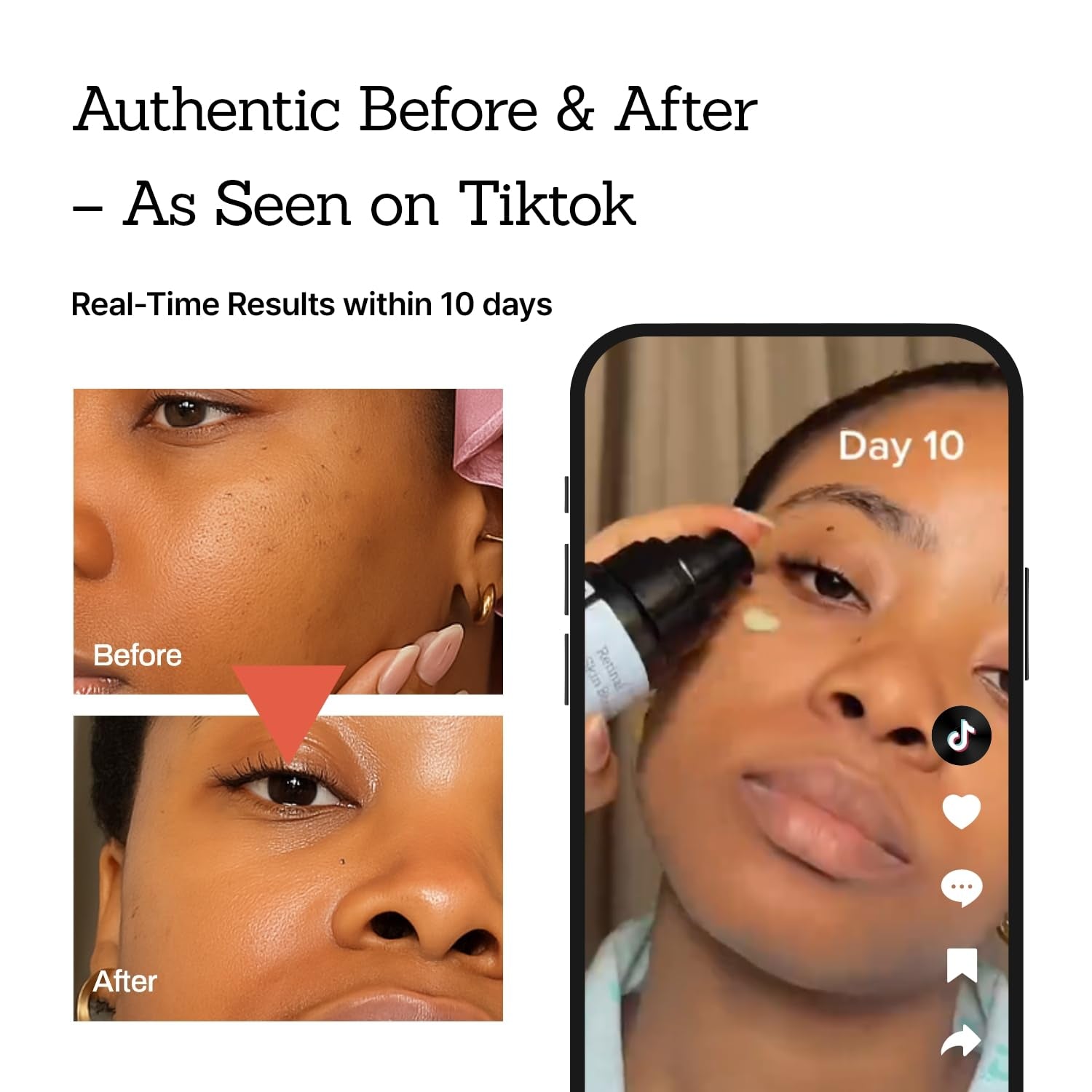 Revitalize Your Skin with Our Vegan Retinal Booster Serum! Perfect for Sensitive Skin, Uneven Tone, and Fine Lines! 🌟✨