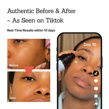 Revitalize Your Skin with Our Vegan Retinal Booster Serum! Perfect for Sensitive Skin, Uneven Tone, and Fine Lines! 🌟✨