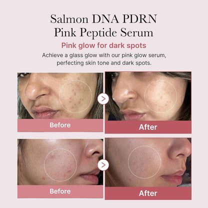 Revitalize Your Skin with Salmon DNA PDRN Pink Peptide Serum! 🌟 Hydrate, Moisturize, and Firm Up Uneven Skin Tone with Niacinamide! 💖 1.01 Fl.Oz.