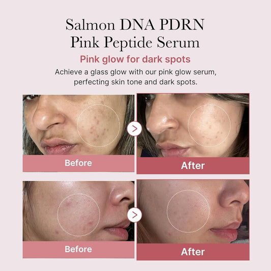 Revitalize Your Skin with Salmon DNA PDRN Pink Peptide Serum! 🌟 Hydrate, Moisturize, and Firm Up Uneven Skin Tone with Niacinamide! 💖 1.01 Fl.Oz.